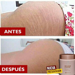 ANTES+Y+DESPUES+04+GEL+CORPS+HINODE